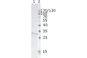 Western Blot testing of HIV-1 recombinant Nef protein. (HIV-1 Nef (AA 31-35) anticorps)