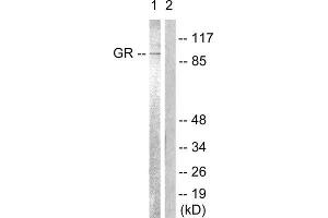 Western Blotting (WB) image for anti-GR (Internal Region), (pSer234), (Ser226), (Ser246) antibody (ABIN1847938) (GR (Internal Region), (pSer234), (Ser226), (Ser246) anticorps)
