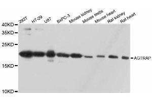 Western blot analysis of extracts of various cell lines, using AGTRAP antibody. (AGTRAP anticorps  (AA 93-152))