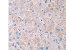 Used in DAB staining on fromalin fixed paraffin- embedded liver tissue