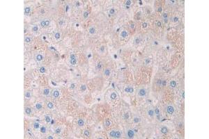 Used in DAB staining on fromalin fixed paraffin- embedded liver tissue (TSTA3 anticorps  (AA 1-321))