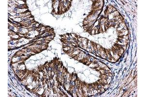 IHC-P Image COX5A antibody [N1C3] detects COX5A protein at mitochondria on mouse prostate by immunohistochemical analysis.