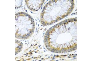 Immunohistochemistry of paraffin-embedded human colon using WNT9A antibody. (WNT9A anticorps)