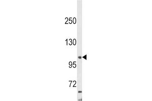 Western Blotting (WB) image for anti-Adaptor-Related Protein Complex 2, alpha 2 Subunit (AP2A2) antibody (ABIN3003799)