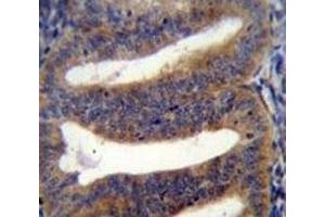 RBPMS2 antibody immunohistochemistry analysis in formalin fixed and paraffin embedded human uterus tissue. (RBPMS2 anticorps  (AA 113-141))