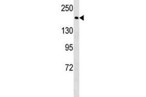 BRCA1 antibody western blot analysis in HeLa lysate.