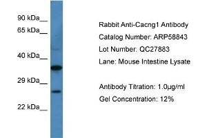 WB Suggested Anti-Cacng1  Antibody Titration: 0. (CACNG1 anticorps  (N-Term))