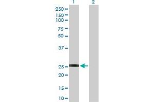Western Blot analysis of GSTO2 expression in transfected 293T cell line by GSTO2 MaxPab polyclonal antibody. (GSTO2 anticorps  (AA 1-243))