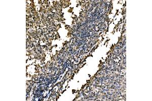 IHC analysis of WAPL/FOE using anti-WAPL/FOE antibody (ABIN7602663). (WAPAL anticorps  (AA 916-1190))