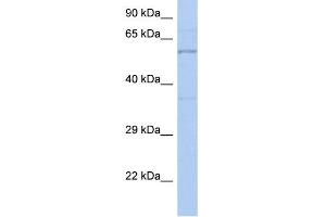 WB Suggested Anti-TH Antibody Titration: 0. (TH anticorps  (N-Term))
