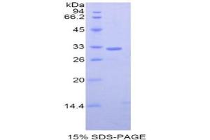 SDS-PAGE analysis of Mouse GRAP2 Protein.