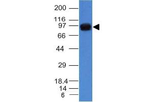 Western Blot of A431 cell lysate using Nucleolin Mouse Monoclonal Antibody (NCL/902).