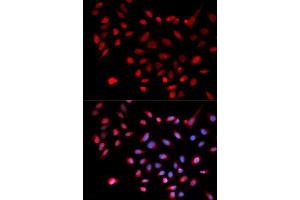 Immunofluorescence analysis of U2OS cells using CDK9 antibody.