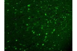 IF analysis of Calbindin using anti-Calbindin antibody (ABIN6719541). (CALB1 anticorps  (AA 2-261))