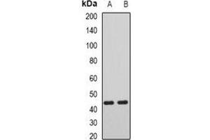Western blot analysis of AIPL1 expression in mouse liver (A), mouse heart (B) whole cell lysates. (AIPL1 anticorps)