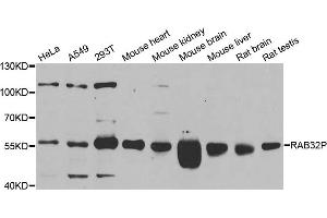 Western blot analysis of extracts of various cell lines, using RAB3IP antibody. (RAB3IP anticorps)