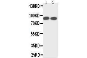 Anti-TrkA antibody,  Western blotting Lane 1: Rat Brain Tissue Lysate Lane 2: Mouse Brain Tissue Lysate (TRKA anticorps  (N-Term))