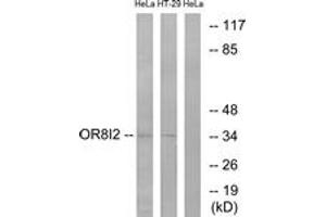 Western blot analysis of extracts from HeLa/HT-29 cells, using OR8I2 Antibody. (OR8I2 anticorps  (AA 55-104))