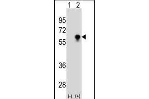 Western blot analysis of CDC25C (arrow) using CDC25C Antibody (ABIN1539792 and ABIN2843765). (CDC25C anticorps)