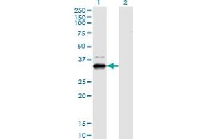 Western Blot analysis of ZNF365 expression in transfected 293T cell line by ZNF365 monoclonal antibody (M03), clone 2E3. (ZNF365 anticorps  (AA 147-219))
