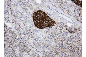 Image no. 1 for anti-CD99 (CD99) antibody (ABIN1497383) (CD99 anticorps)