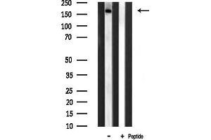 anti-FYVE and Coiled-Coil Domain Containing 1 (FYCO1) (Internal Region) antibody