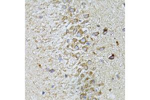 anti-Melatonin Receptor 1A (MTNR1A) (AA 281-350) antibody