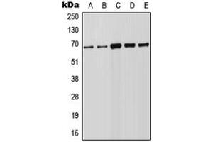 Western blot analysis of FOXN1 expression in Raji (A), HeLa (B), A549 (C), NIH3T3 (D), PC12 (E) whole cell lysates.