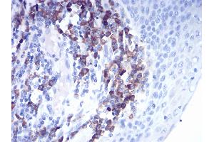 Immunohistochemical analysis of paraffin-embedded esophagus tissues using CTSD mouse mAb with DAB staining.