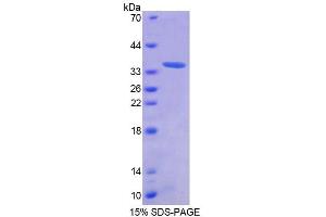 SDS-PAGE (SDS) image for Antizyme Inhibitor 1 (AZIN1) (AA 5-290) protein (His tag) (ABIN6238743)