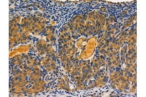 ABIN6261604 and ABIN6266802 at 1/100 staining Rat ovarian tissue by IHC-P. (EPS8-Like 2 anticorps  (N-Term))