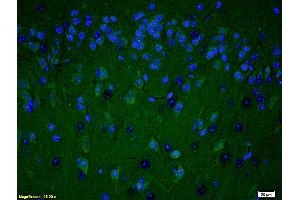 Formalin-fixed and paraffin embedded rat brain labeled with Anti PARP (N-Terminus) Polyclonal Antibody, Unconjugated (ABIN677903) at 1:200 followed by conjugation to the secondary antibody Goat Anti-Rabbit IgG, FITC conjugated used at 1:200 dilution for 40 minutes at 37°C and DAPI