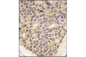 Immunohistochemistry (IHC) image for anti-PTEN Induced Putative Kinase 1 (PINK1) antibody (ABIN356391) (PINK1 anticorps)
