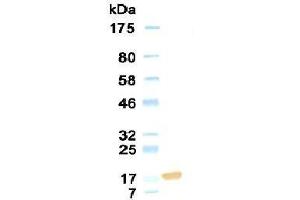 Western Blotting (WB) image for anti-Collagen, Type XVIII, alpha 1 (COL18A1) antibody (ABIN933868) (COL18A1 anticorps)