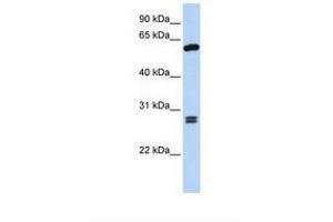 Image no. 1 for anti-Adrenocortical Dysplasia Homolog (ACD) (AA 398-447) antibody (ABIN6739073) (ACD anticorps  (AA 398-447))