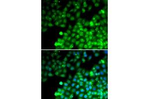 Immunofluorescence analysis of MCF7 cells using TAGLN2 antibody. (TAGLN2 anticorps  (AA 1-199))