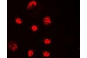 Immunofluorescent analysis of Lupus La (pS366) staining in HeLa cells. (Lupus La (C-Term), (pSer366) anticorps)