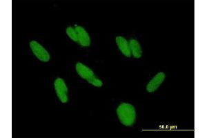 Immunofluorescence of purified MaxPab antibody to HKR3 on HepG2 cell. (ZBTB48 anticorps  (AA 1-688))