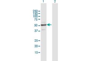 Western Blot analysis of ZNF772 expression in transfected 293T cell line by ZNF772 MaxPab polyclonal antibody. (ZNF772 anticorps  (AA 1-489))