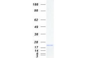 Validation with Western Blot