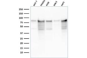 Western Blot Analysis of MCF-7, HEK-293, A549, SKBr3, HeP2 cell lysates using MCM7 Recombinant Mouse Monoclonal Antibody (rMCM7/1468). (Recombinant MCM7 anticorps  (AA 195-319))