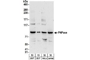 Western Blotting (WB) image for anti-Polyribonucleotide Nucleotidyltransferase 1 (PNPT1) (AA 700-750) antibody (ABIN7449791)