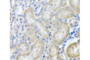 Immunohistochemistry of paraffin-embedded Mouse kidney using HDAC6 Polyclonal Antibody at dilution of 1:100 (40x lens). (HDAC6 anticorps)