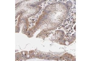 Immunohistochemical staining (Formalin-fixed paraffin-embedded sections) of human stomach with ARHGEF6 polyclonal antibody  shows cytoplasmic and membranous positivity in glandular cells.