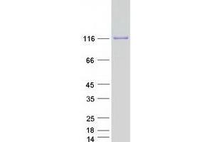 Validation with Western Blot