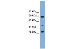 Western Blot showing TRAPPC5 antibody used at a concentration of 1-2 ug/ml to detect its target protein. (TRAPPC5 anticorps  (N-Term))