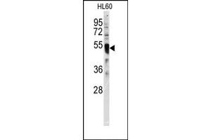 Image no. 1 for anti-Interferon Regulatory Factor 8 (IRF8) (C-Term) antibody (ABIN357999) (IRF8 anticorps  (C-Term))
