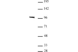 MED15 antibody (pAb) tested by Western blot. (MED15 anticorps  (C-Term))