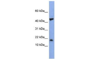 WB Suggested Anti-LSM1 Antibody Titration:  0. (LSM1 anticorps  (Middle Region))