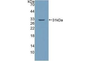 Detection of Recombinant PALLD, Human using Polyclonal Antibody to Palladin (PALLD) (PALLD anticorps  (AA 1137-1383))